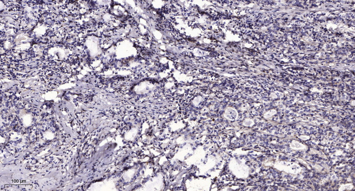 CCD19 Polyclonal Antibody