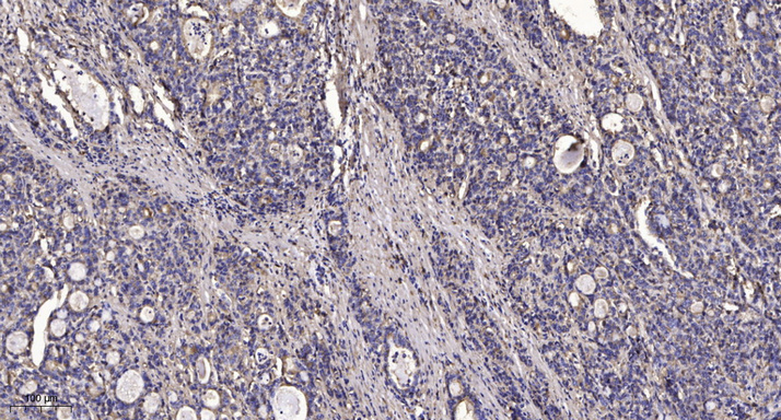 FKBP1A/B  Polyclonal Antibody