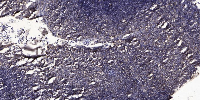 TRY2 Polyclonal Antibody