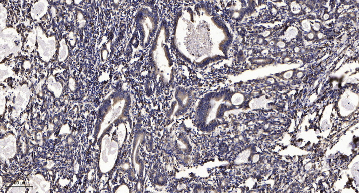 Shh Polyclonal Antibody