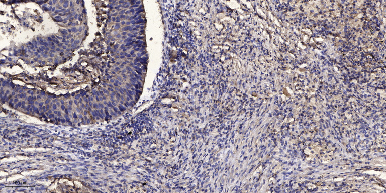 PCP Polyclonal Antibody