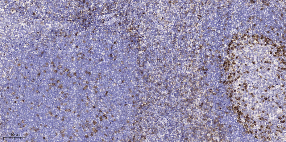 CD105 Polyclonal Antibody