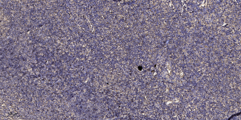 GP-39 Polyclonal Antibody