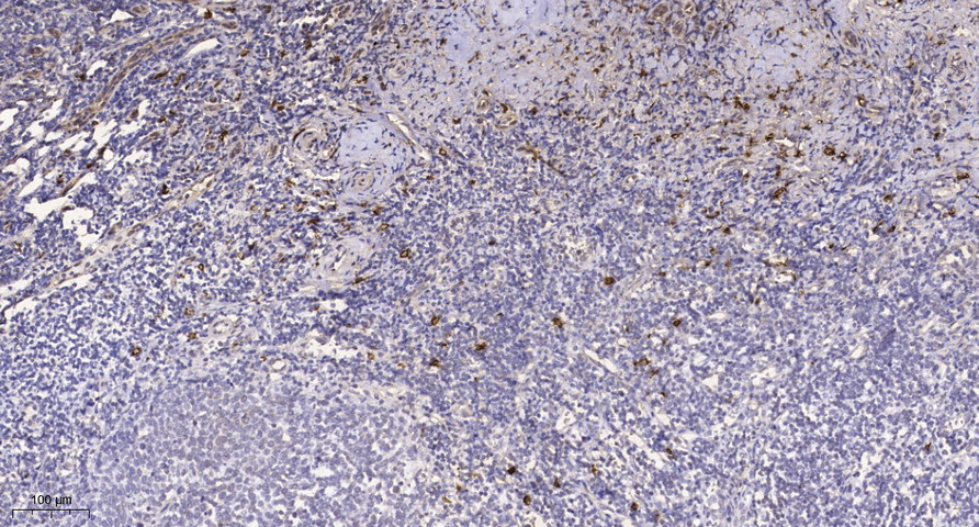 MICB Polyclonal Antibody