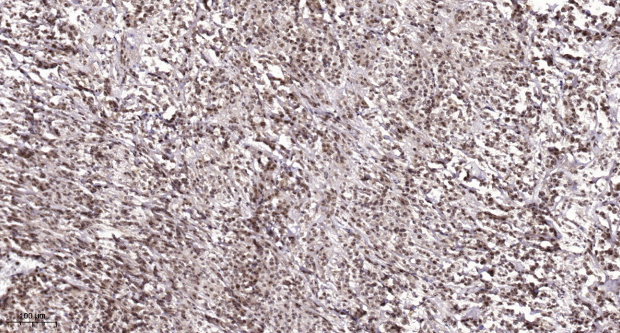 PKIG Polyclonal Antibody