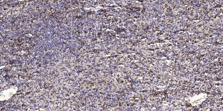 S100A7A Polyclonal Antibody