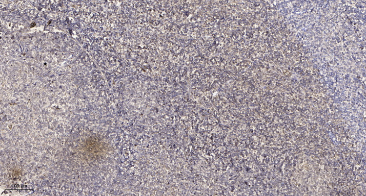 FKBP1B  Polyclonal Antibody