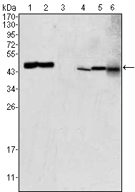 AATM Monoclonal Antibody