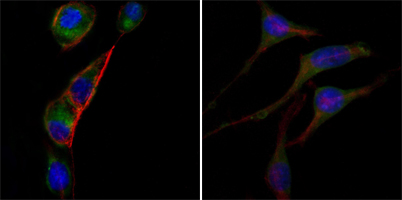 AATM Monoclonal Antibody