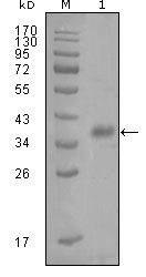 A-FABP Monoclonal Antibody