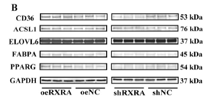 A-FABP Monoclonal Antibody