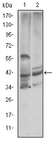 Cystatin C Monoclonal Antibody