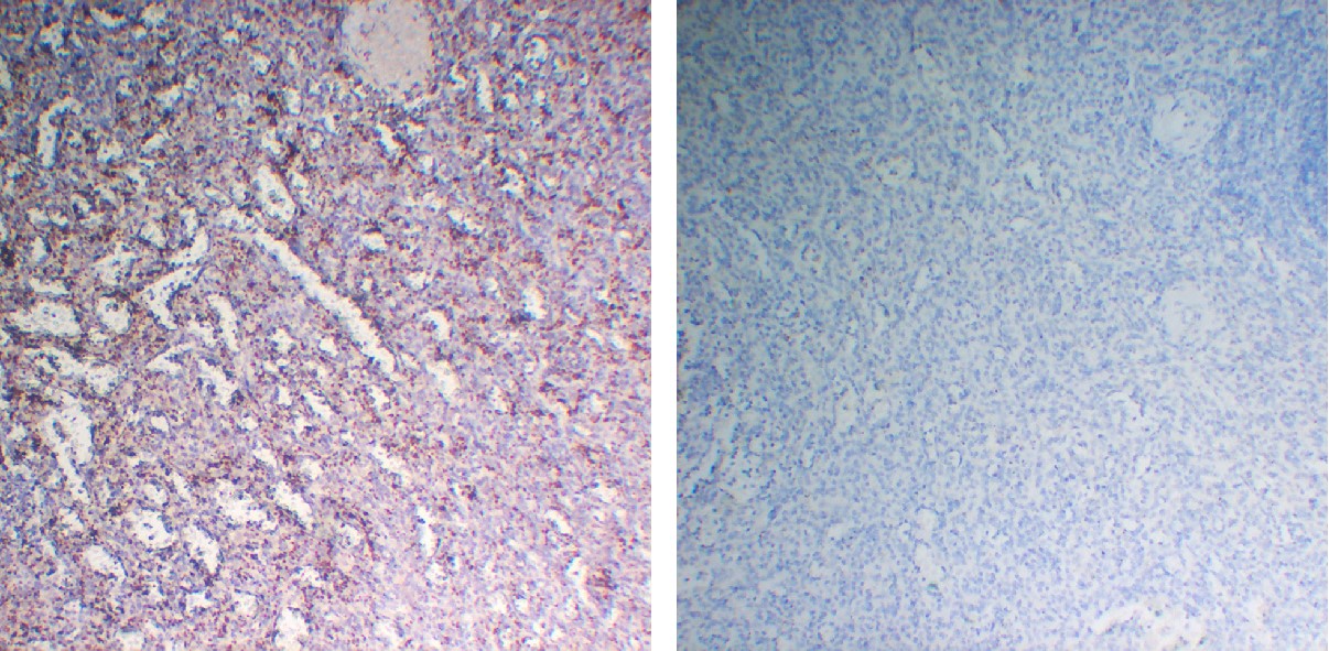 Negative Control for mouse IgG1, kappa Primary Antibody