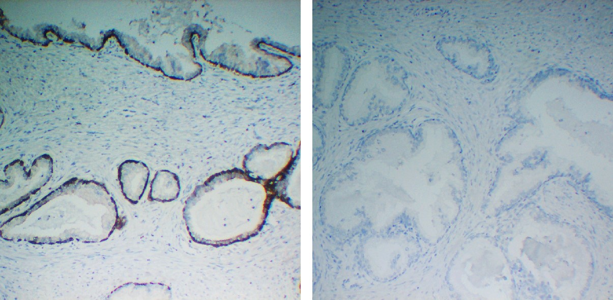 Negative Control for mouse IgG2a, kappa Primary Antibody