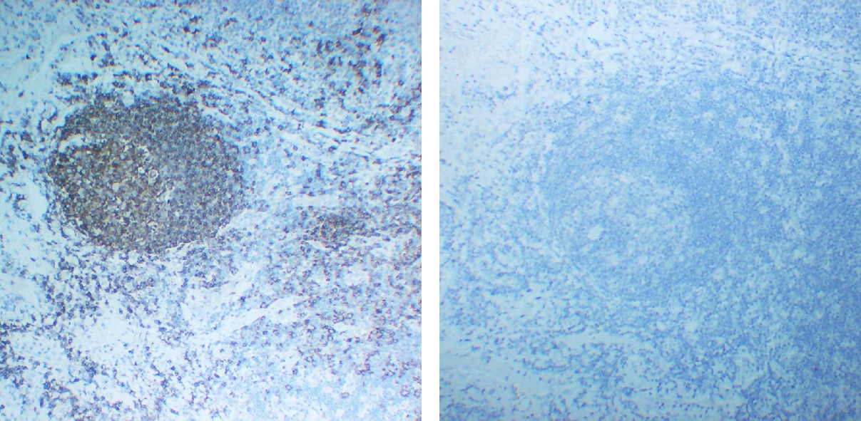 Negative Control for mouse IgG2b, kappa Primary Antibody