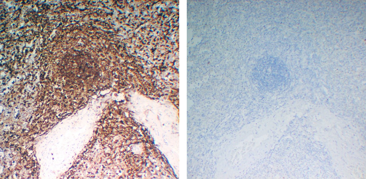 Negative Control for mouse IgG2b, kappa Primary Antibody