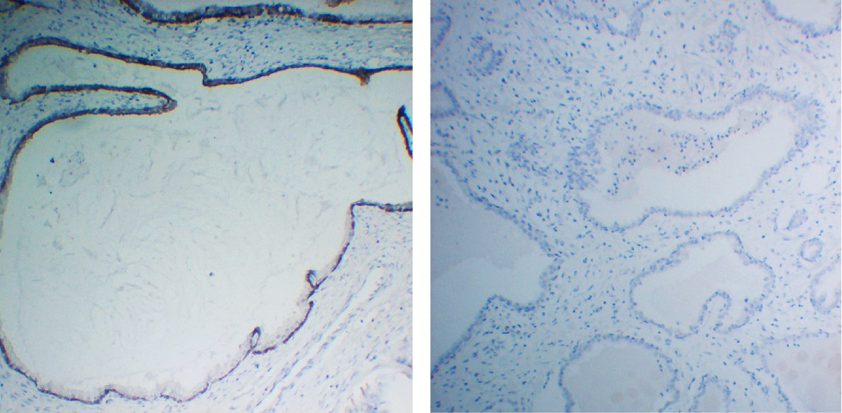 Negative Control for mouse IgG2b, kappa Primary Antibody