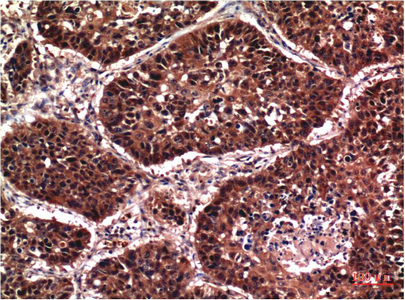 Phospho Akt (S473) mouse Monoclonal Antibody(7F9)