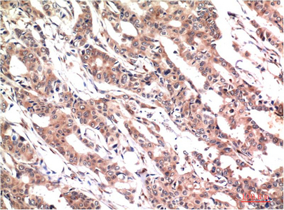 Phospho Stat3 (Y705) mouse Monoclonal Antibody(1E9)