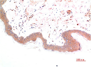 Phospho Smad3(S425) mouse Monoclonal Antibody(1D9)
