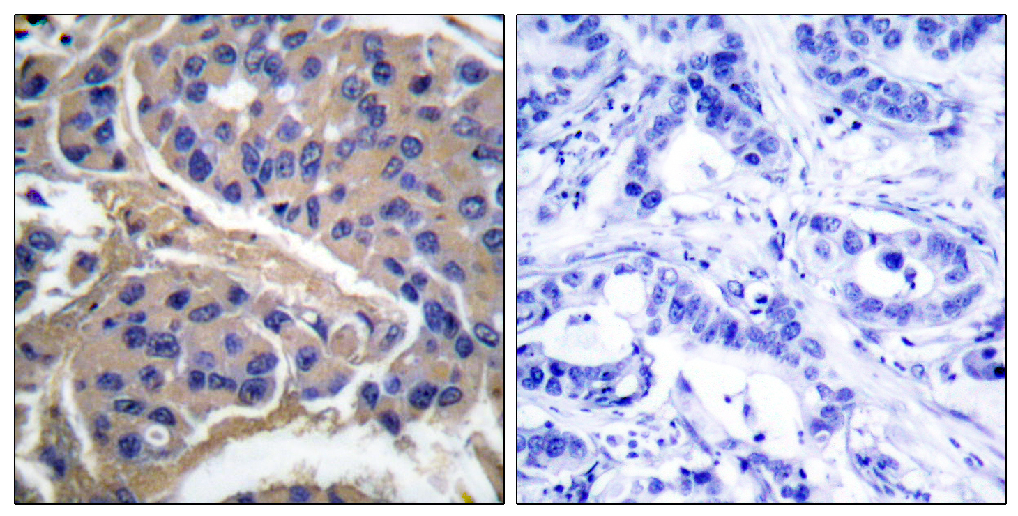 IRS-1 (phospho Ser307) Polyclonal Antibody