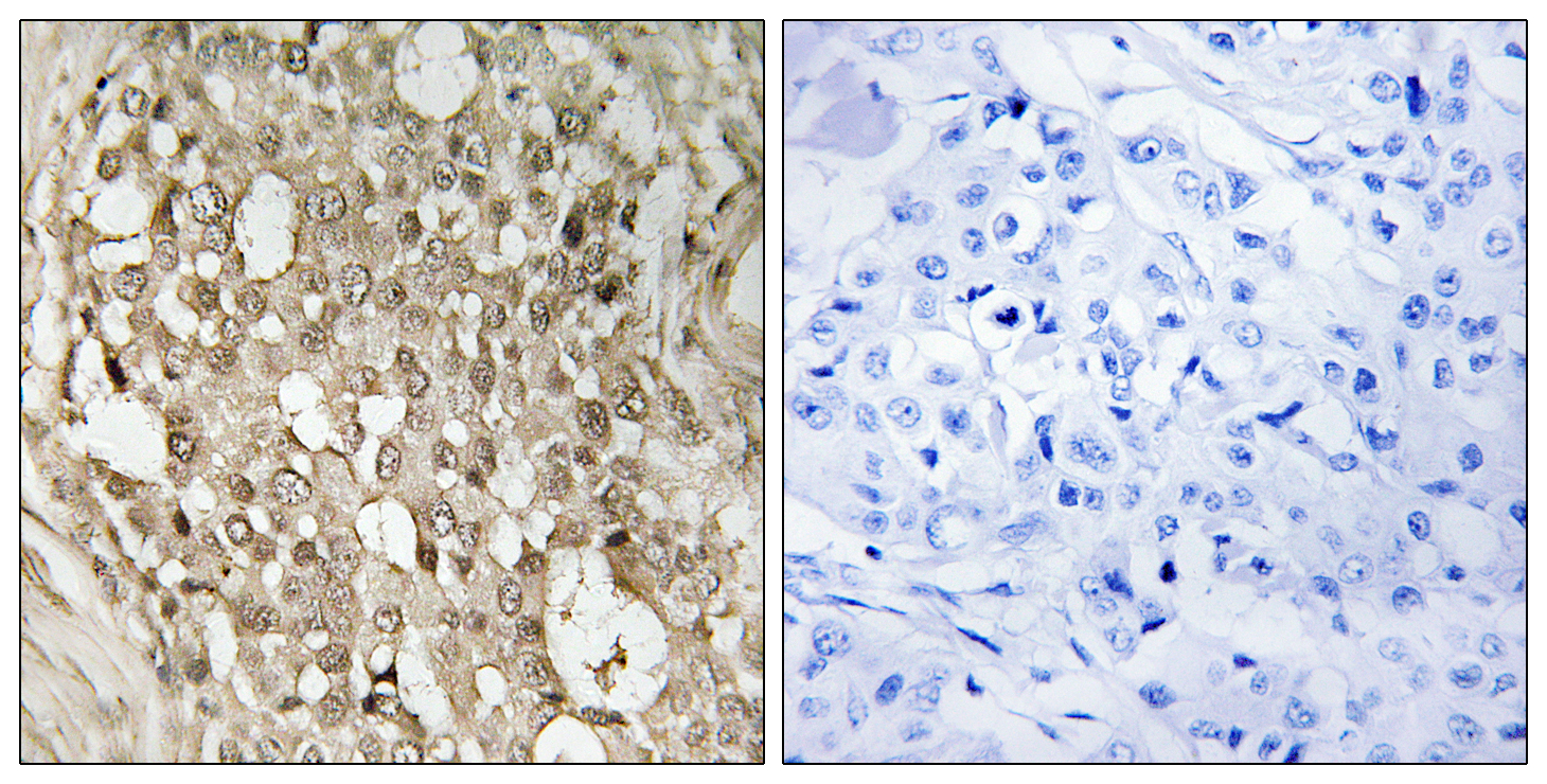 NFκB-p65 (phospho Ser529) Polyclonal Antibody
