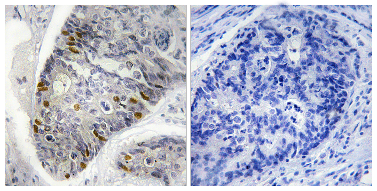 Histone H1 (phospho Thr17) Polyclonal Antibody