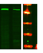 ACAP1 (phospho Ser554) Polyclonal Antibody