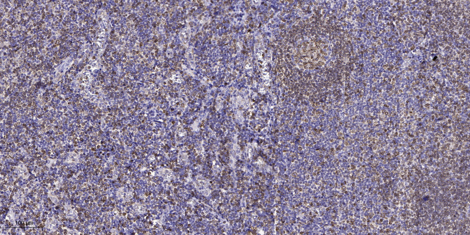 FAK (Phospho Ser732) Polyclonal Antibody