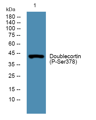 Doublecortin (Phospho Ser378) Polyclonal Antibody