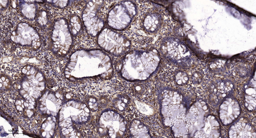 EGFR (Phospho Tyr998) Polyclonal Antibody