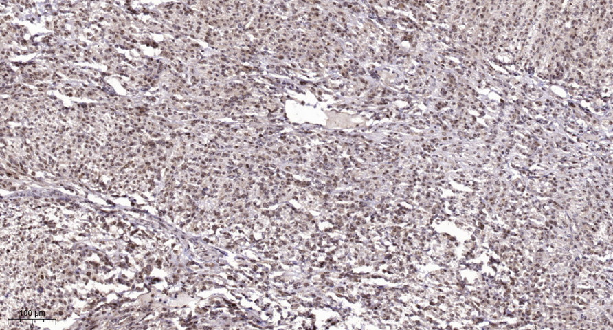 P63-α Mouse Monoclonal Antibody(3F11)