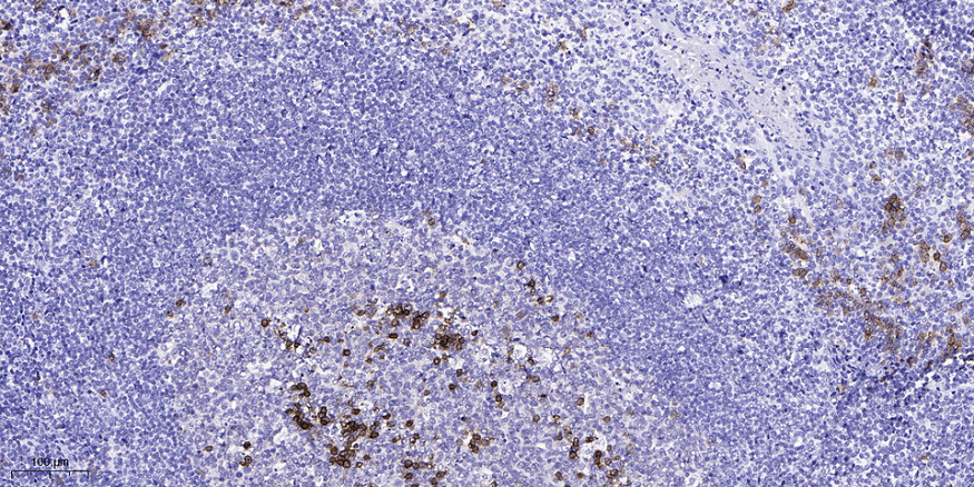 SREBP-1 (Acetyl-Lys324) Polyclonal Antibody