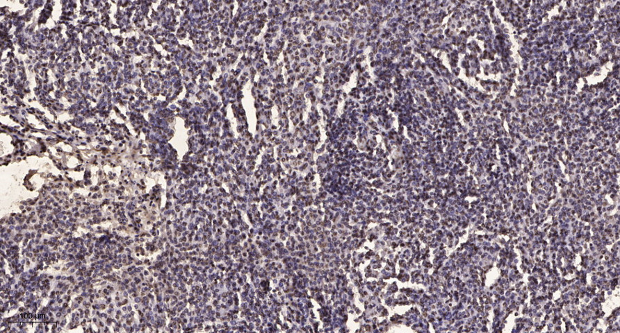 Smad2/3 (Acetyl-Lys19) Polyclonal Antibody