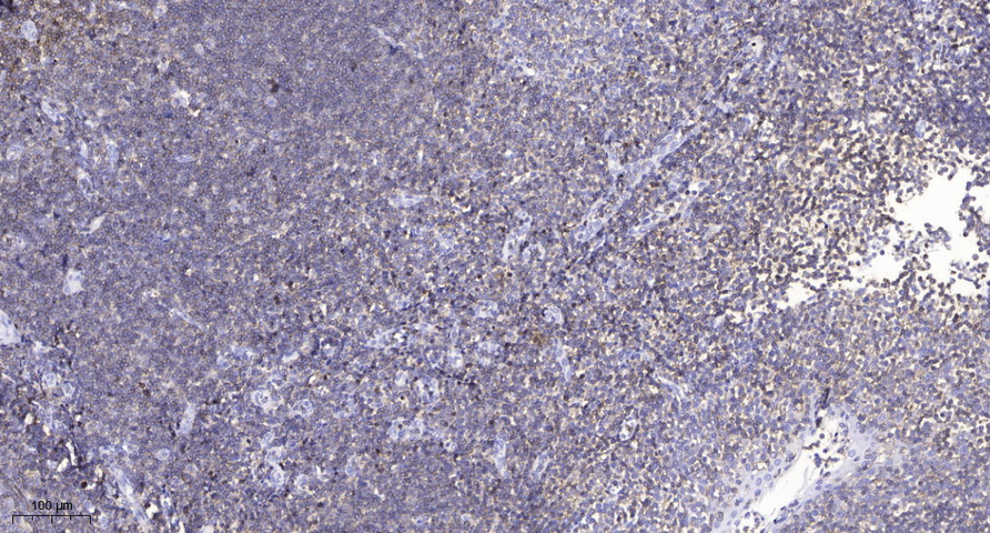 CFTR (Phospho Ser737) Polyclonal Antibody