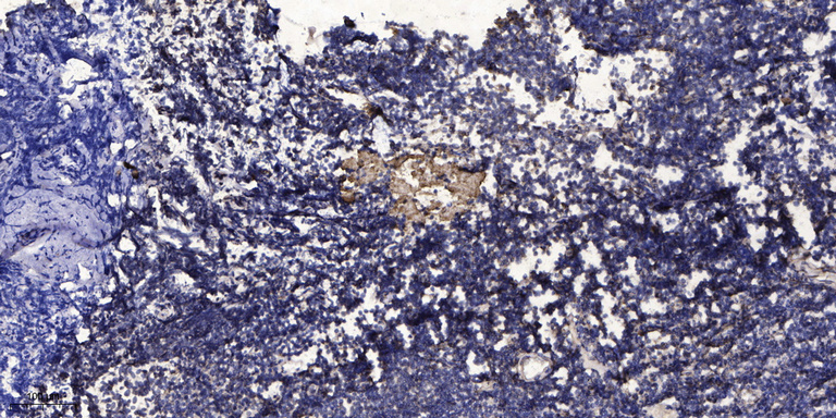 Transferrin Monoclonal Antibody(10C7)