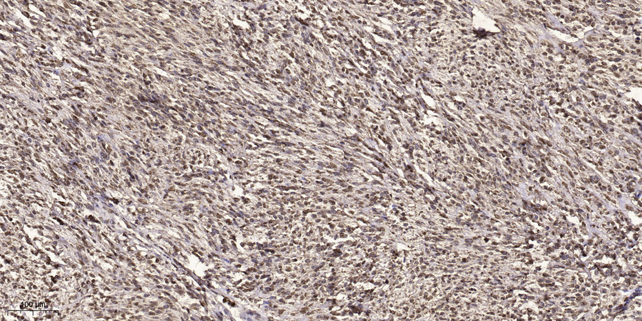 Acetyl NF kB P65(K314/K315) mouse Monoclonal Antibody(2A11)