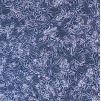 U-87 MG 人脑星形胶质母细胞瘤