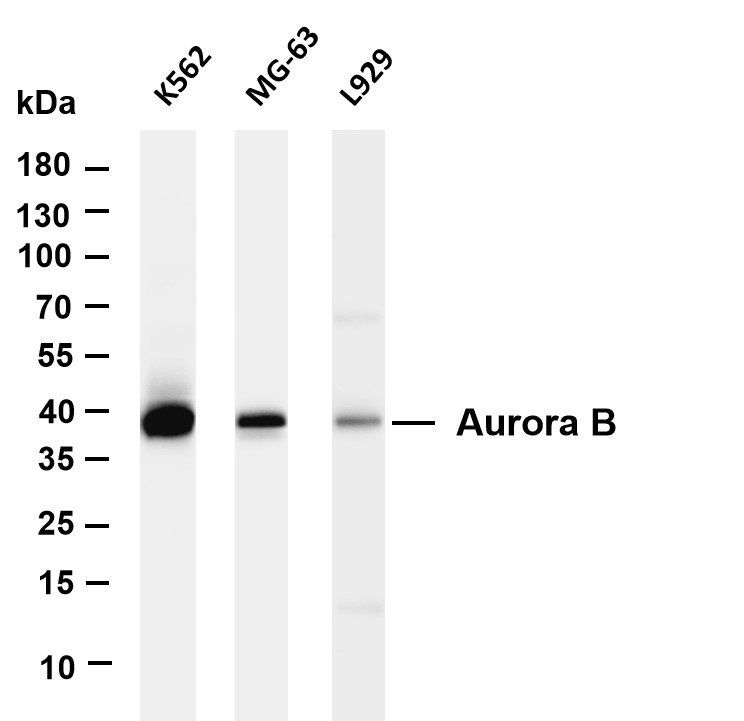 Aurora B (PT0246R) PT® Rabbit mAb