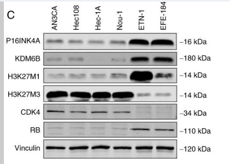 Histone H3 (Tri Methyl Lys27) Polyclonal Antibody
