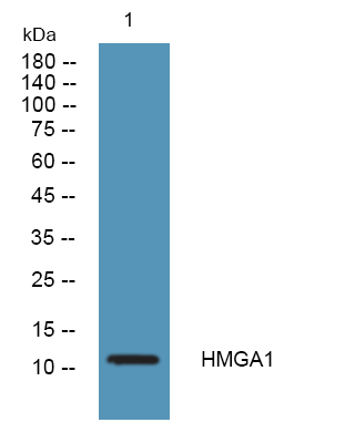 HMG-I/HMG-Y  Polyclonal Antibody
