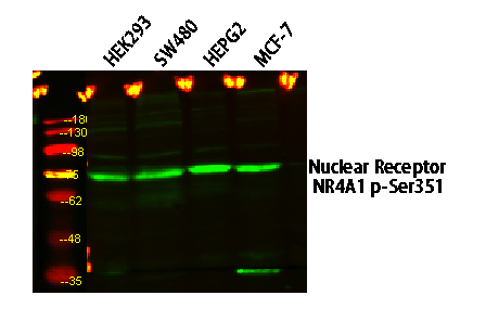 Nuclear Receptor NR4A1 (Phospho Ser351) Antibody