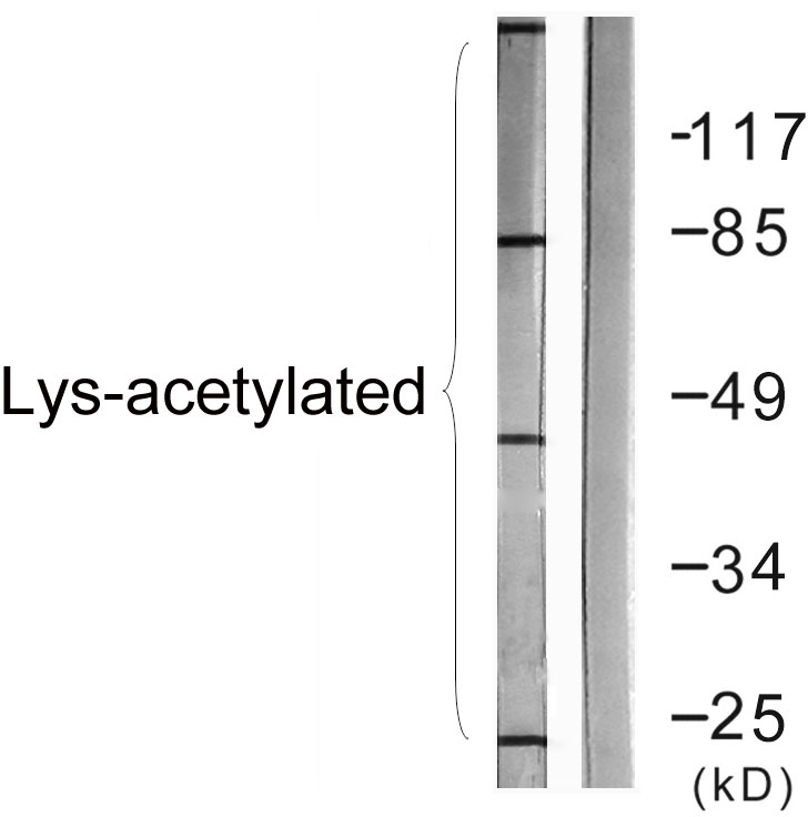Acetyl Lys proteins Polyclonal Antibody