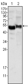 AAT Monoclonal Antibody