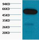 β I tubulin Monoclonal Antibody