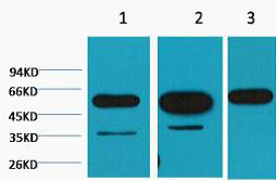 β-tubulin Monoclonal Antibody(M7)