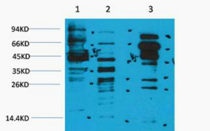 Acetyl Kine Polyclonal Antibody