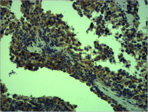 TLR4 Polyclonal Antibody