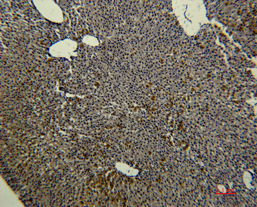 Transferrin Monoclonal Antibody(3A5)