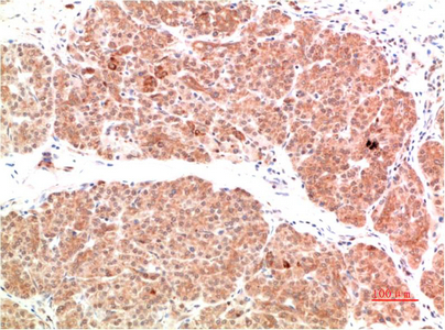 PI 3 Kinase P85 Rabbit Polyclonal Antibody